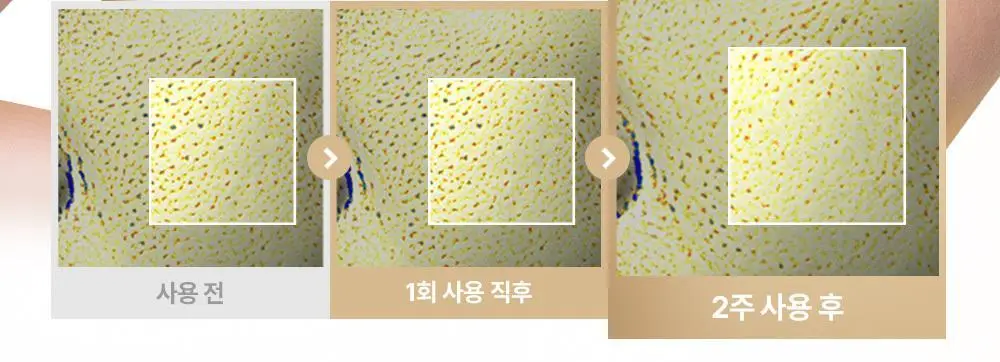 [올리브영 단독기획] 믹순 콩 에센스 50ml 기획 (+병풀 에센스 20ml) 상세페이지 24